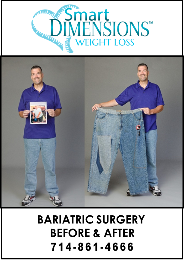 Bariatric Surgery Before After Los Angeles Fountain Valley CA